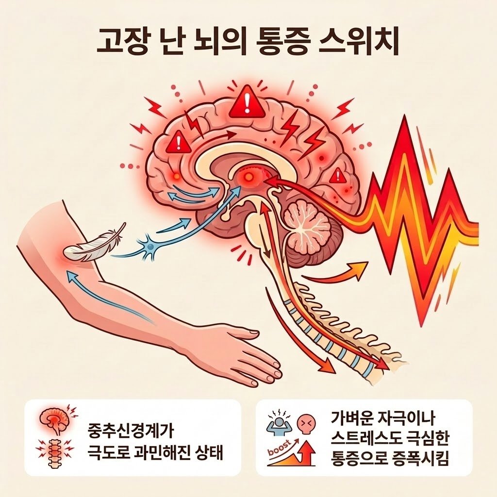 중추신경계 민감화 섬유근육통 원인 뇌 통증 스위치