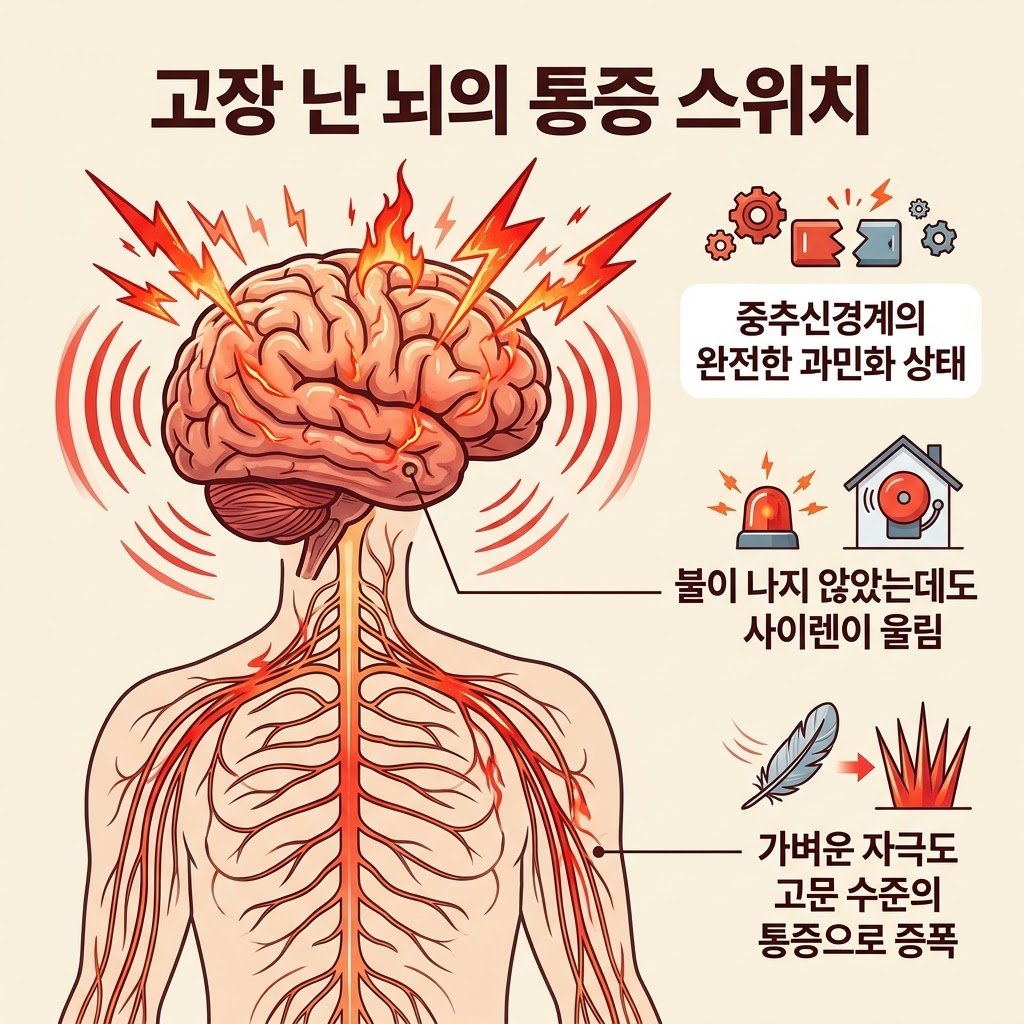 섬유근육통 원인 중추신경계 민감화 뇌 화재경보기 오작동