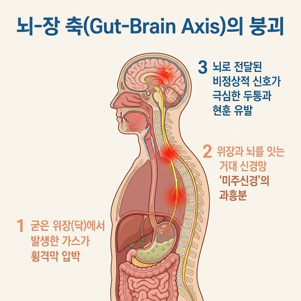 미주신경 뇌장축 담적 가스 횡격막 압박 두통 원인 인포그래픽