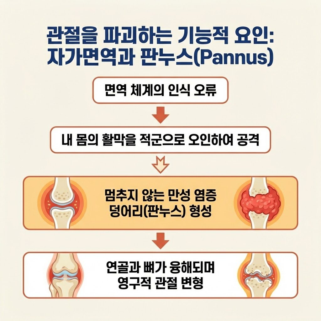 자가면역질환 활막염 판누스 관절 변형 원인