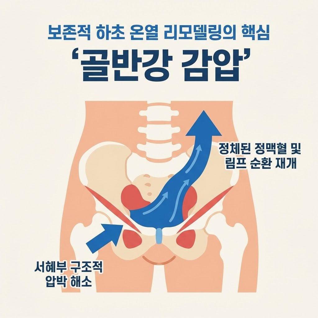 골반강 감압 서혜부 압박 해소 보존적 치료