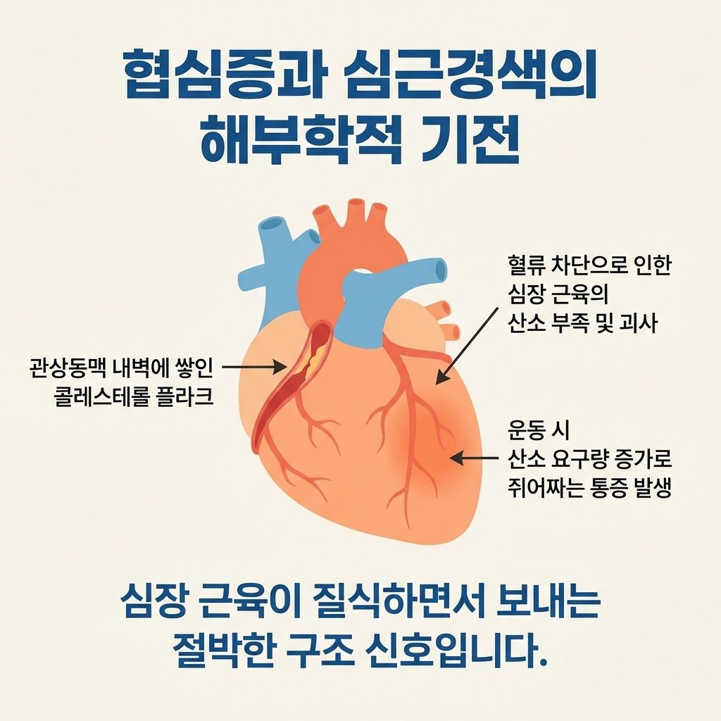 관상동맥 플라크 심장근육 괴사 기전