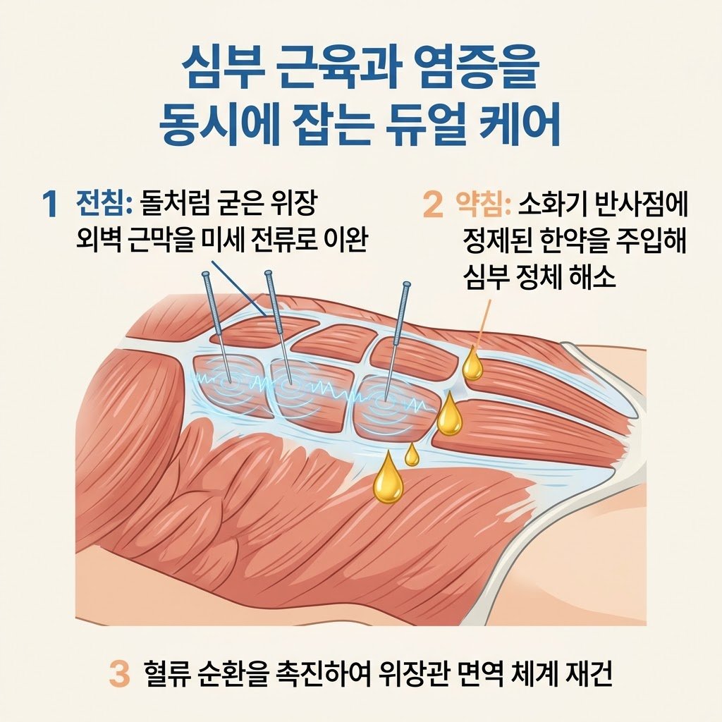복부 전침 약침 치료 담적 이완 소화기 염증 해소 인포그래픽