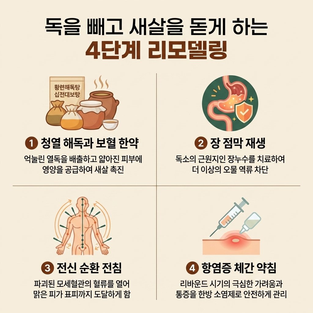 탈스테로이드 한의원 치료 황련해독탕 십전대보탕 장점막재생 약침 전침