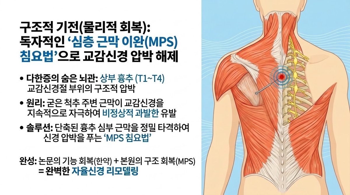다한증 원인 상부 흉추 교감신경 압박 해소, 청보한의원 MPS 심층 근막 침요법 구조적 치료