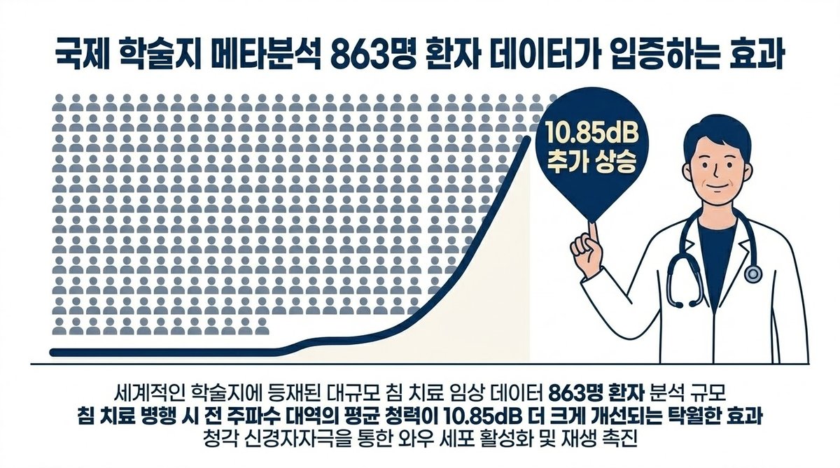 863명 대상 돌발성 난청 침 치료 연구 데이터