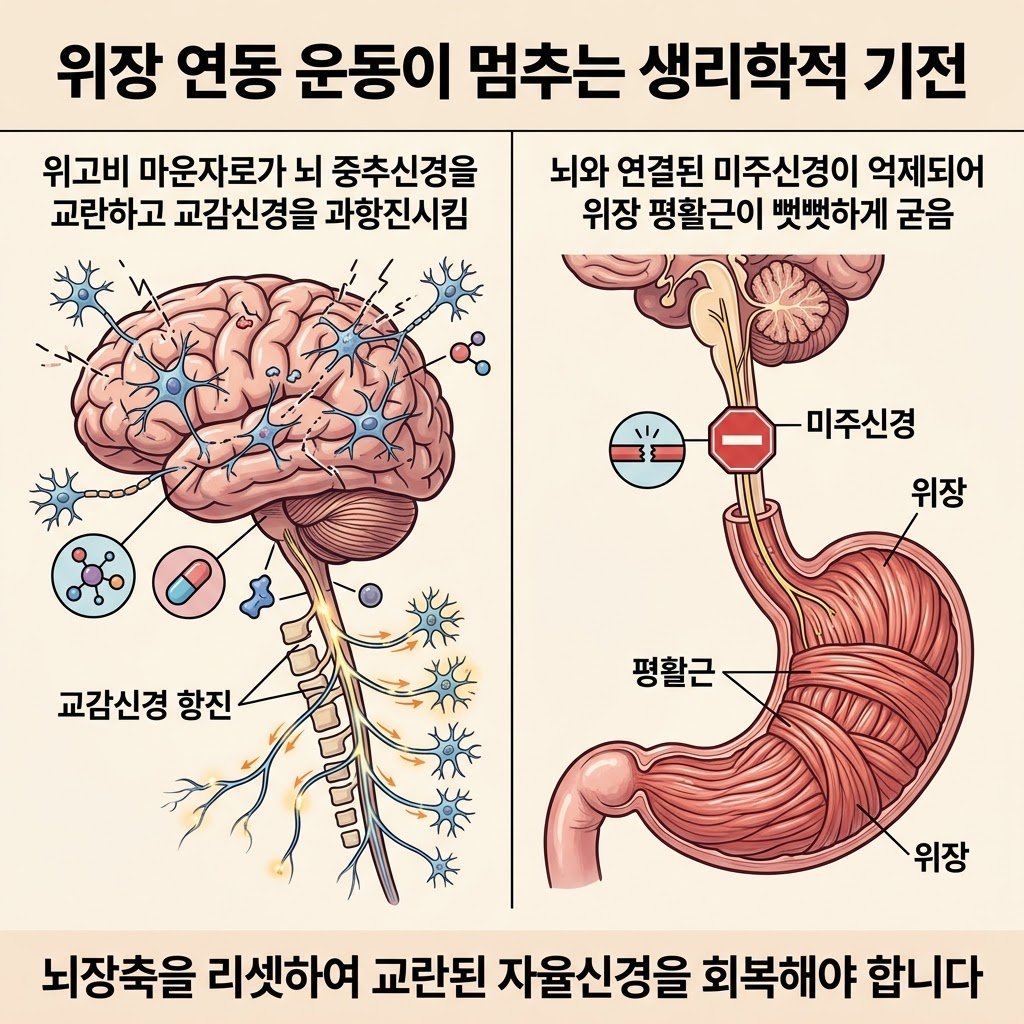 위장 마비 원인 생리학적 기전 뇌장축 미주신경 억제 교감신경 과항진