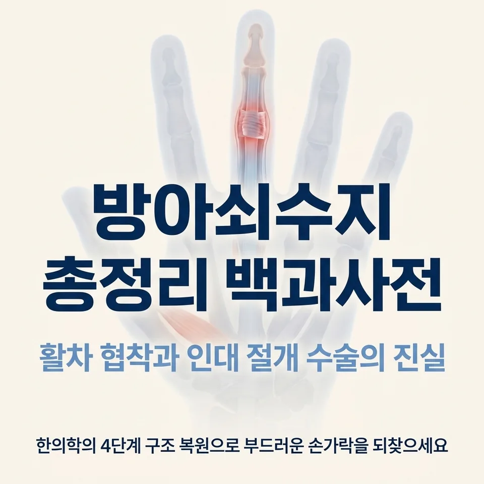 방아쇠수지 A1 활차 힘줄 마찰 실루엣