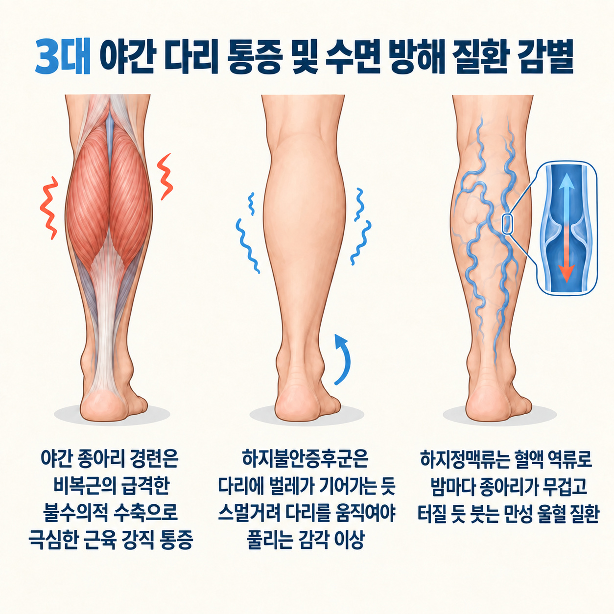 3대 야간 다리 통증 및 수면 방해 질환 감별 인포그래픽