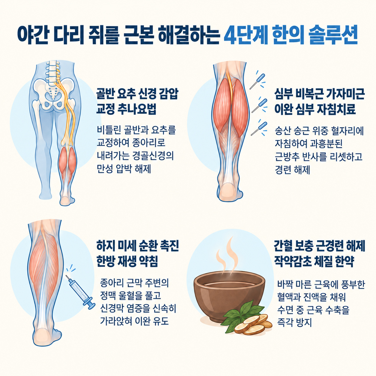 4단계 비수술 야간 다리 쥐 한의 솔루션