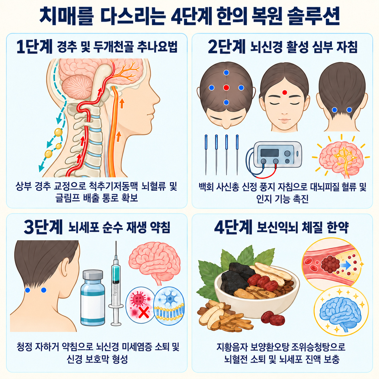 치매를 다스리는 4단계 한의 복원 솔루션 인포그래픽