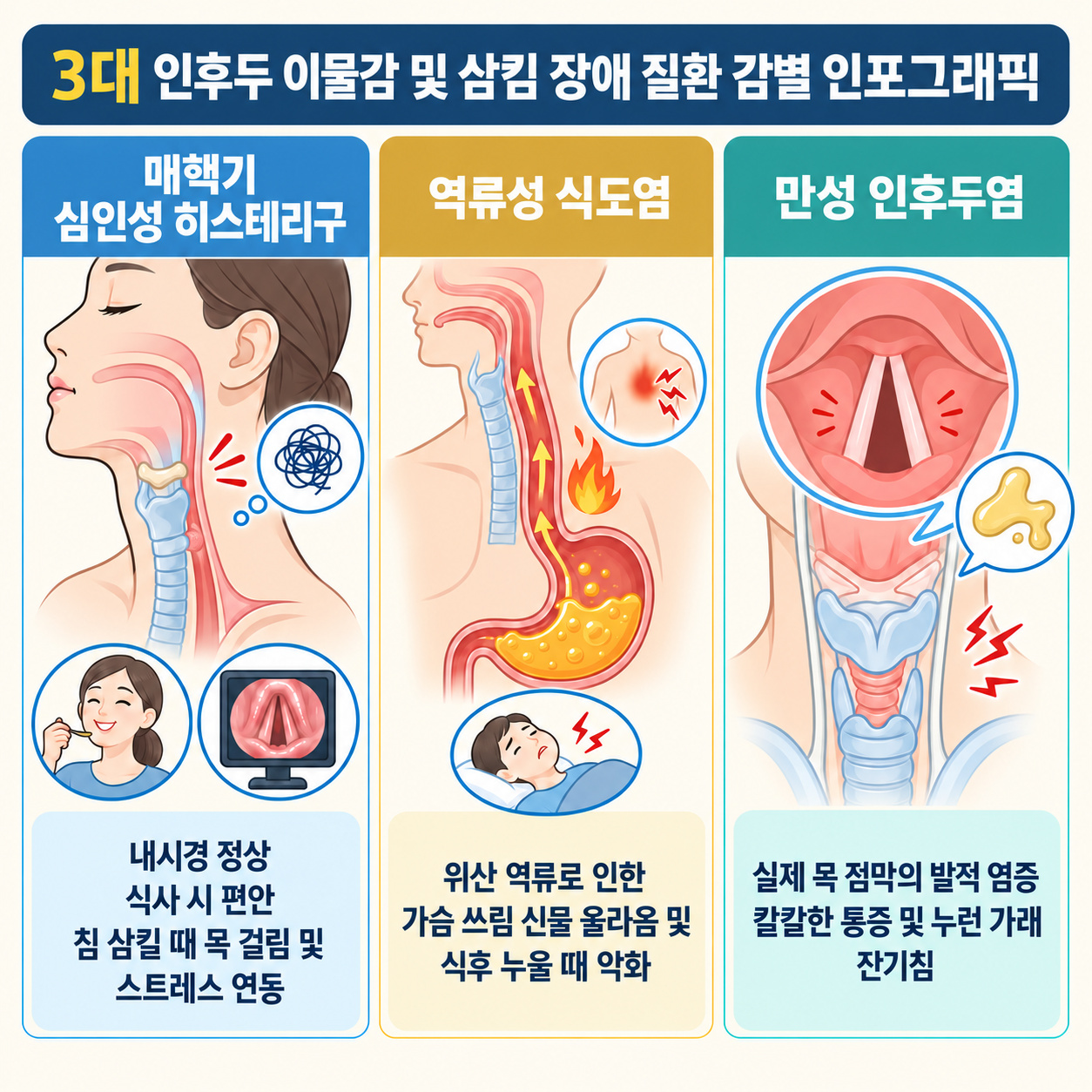 3대 인후두 이물감 및 삼킴 장애 질환 감별 인포그래픽
