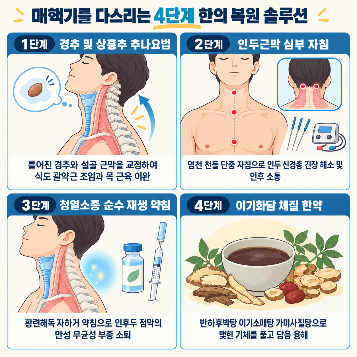 매핵기를 다스리는 4단계 한의 복원 솔루션 인포그래픽